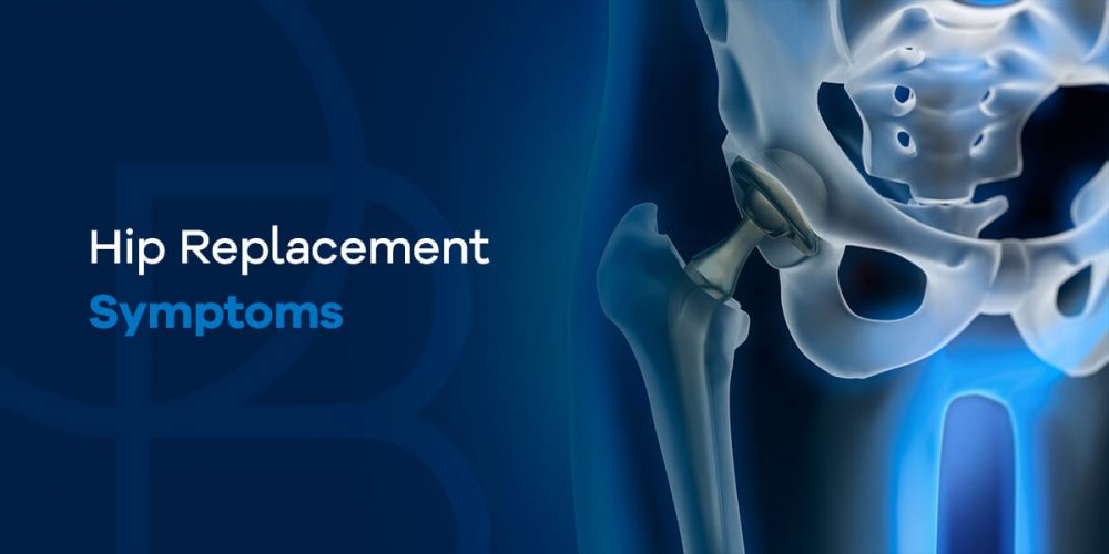 8 Signs To Know If You Need Hip Replacement Surgery