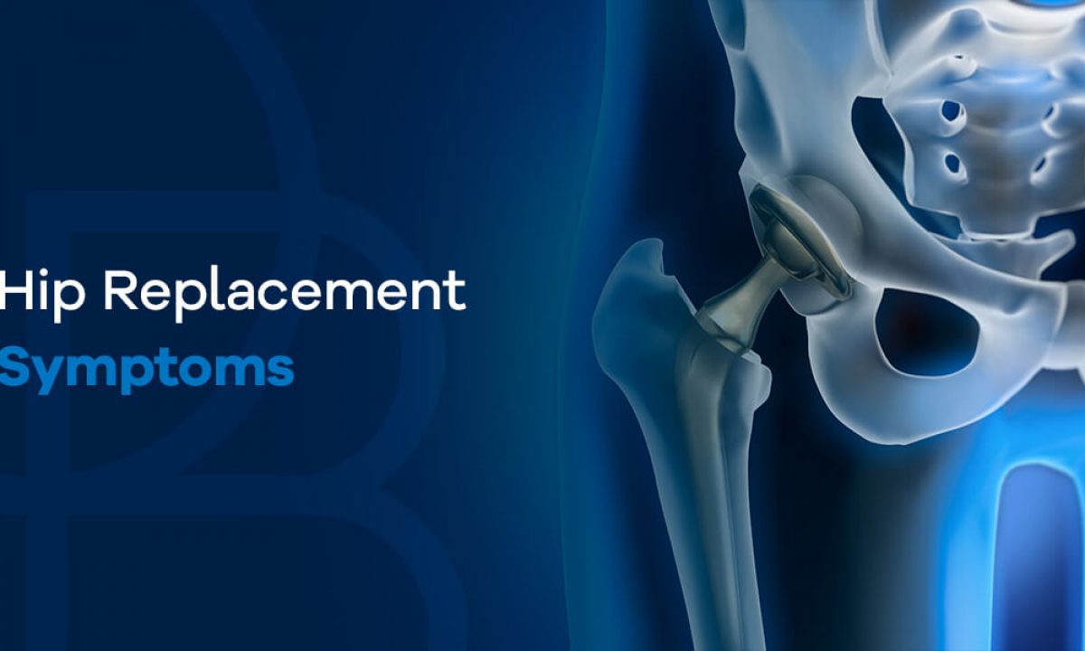 Does This Patient Have Hip Osteoarthritis? 