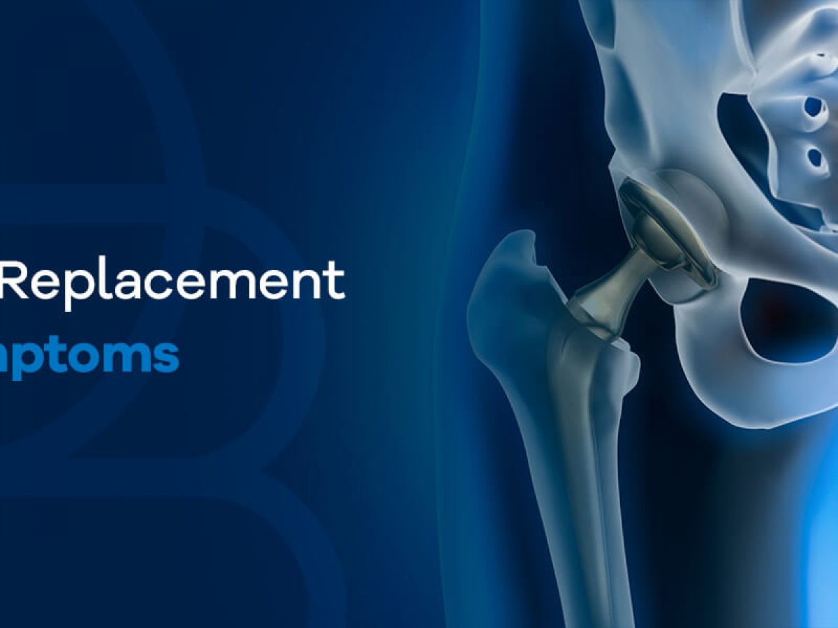 Total Hip Replacement: Types, Procedures, Recovery, Exercises