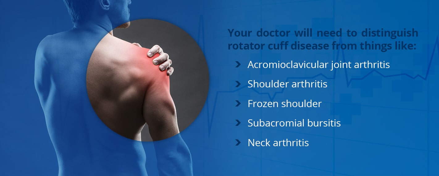 Rotator cuff tear: Signs and symptoms of this serious shoulder