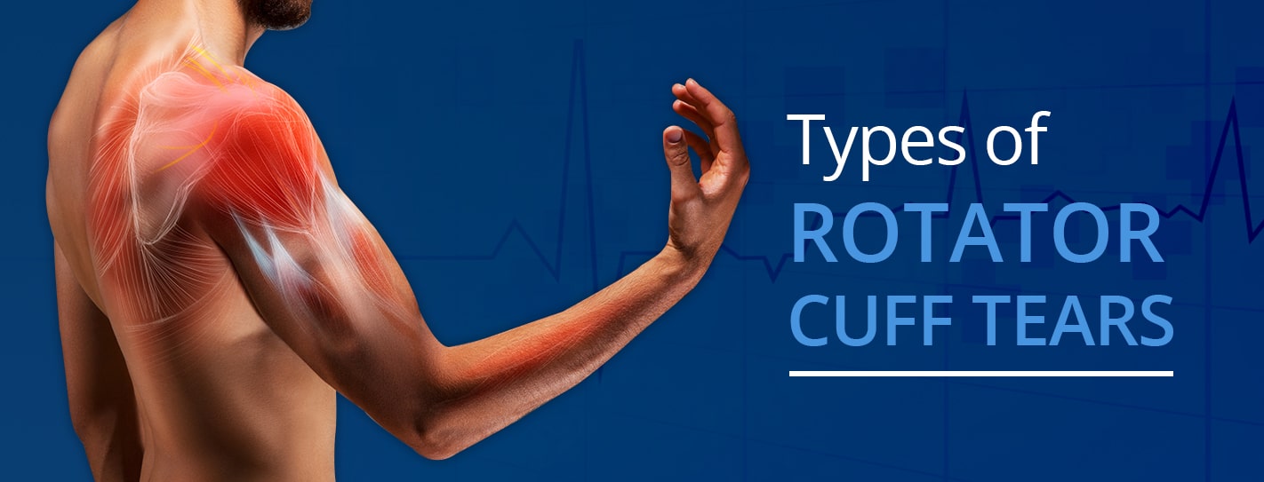 signs and symptoms of torn rotator cuff