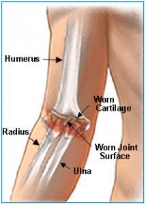 Elbow Treatment & Services in Bethesda MD