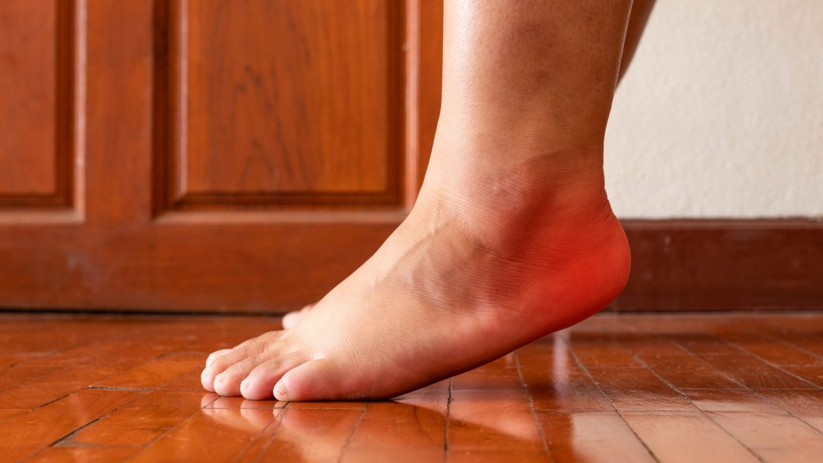 most effective treatment for plantar fasciitis
