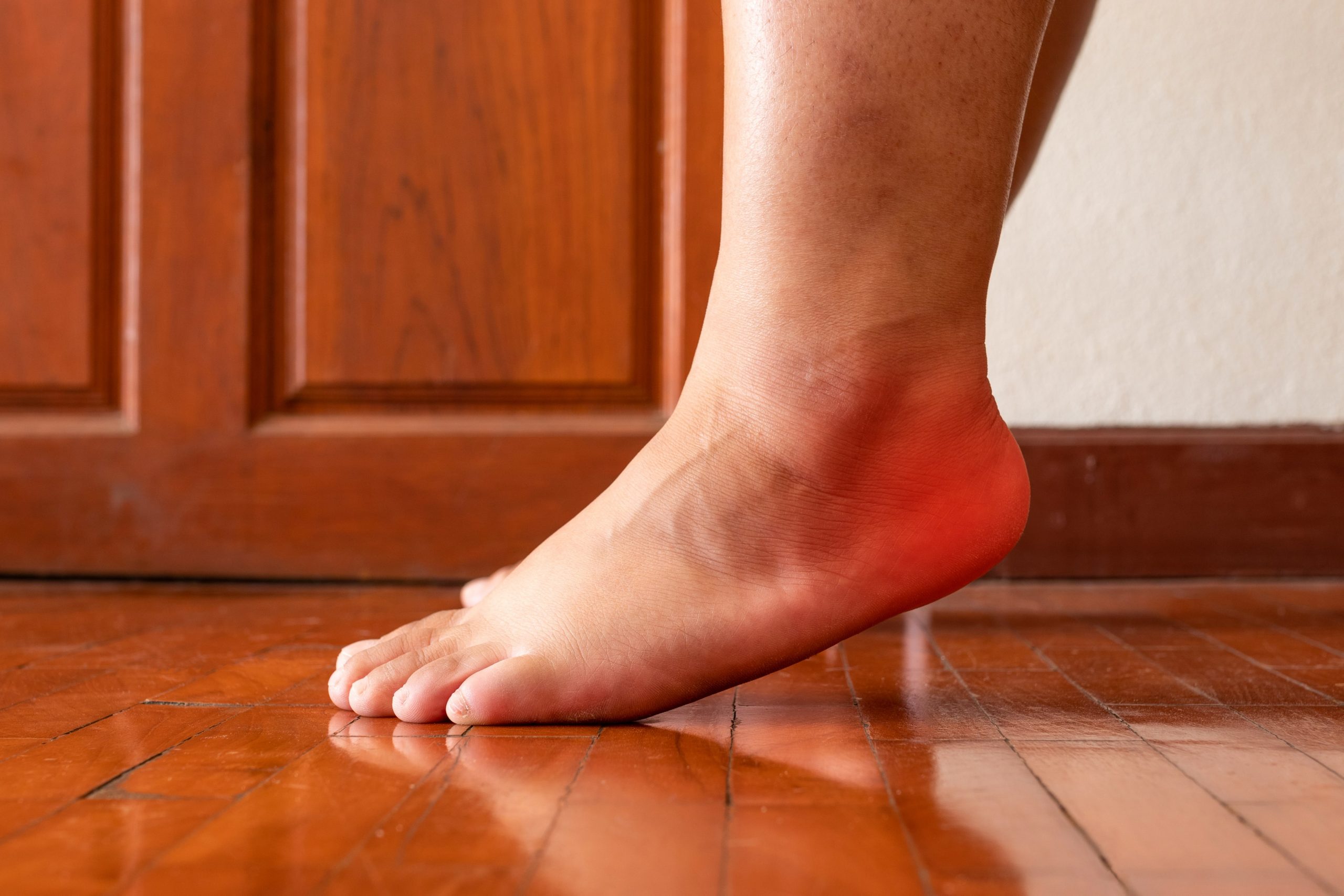 remedies for planters fasciitis